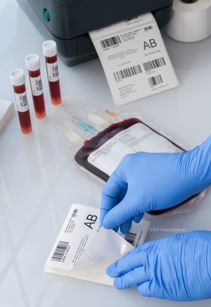  Etiqueta para Bolsa De Sangue - Etiqueta para Hemocomponentes 